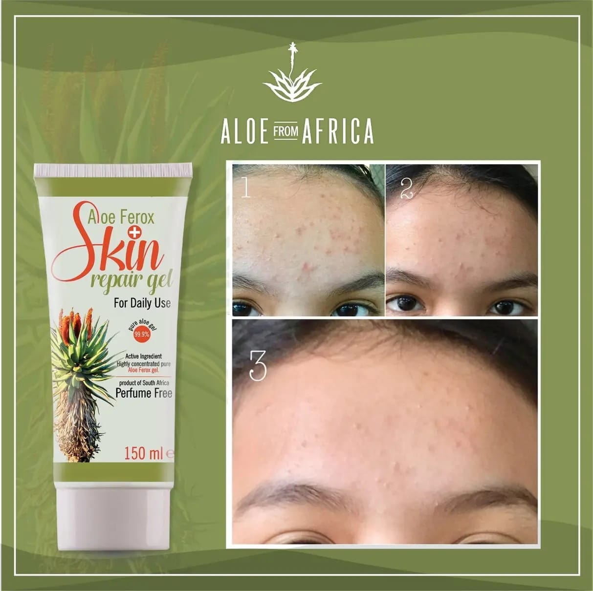 Aloe Ferox Skin Repair Gel