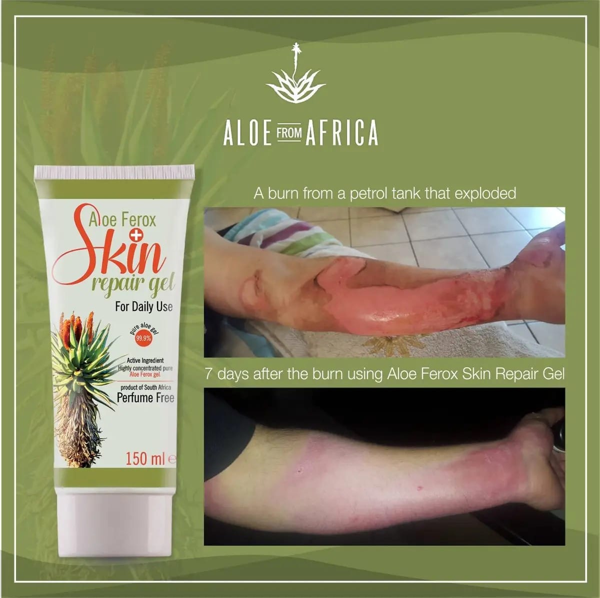 Aloe Ferox Skin Repair Gel